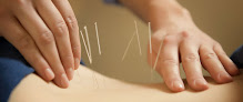 Clínica Enfermería Y Acupuntura médico general en Vélez-Málaga