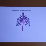 Guía básica de resucitación cardiopulmonar